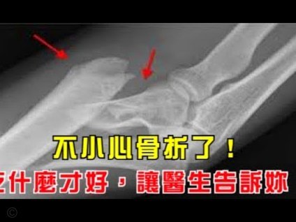 希门尼斯：从颅骨骨折到世界杯破门 用进球告慰亡父