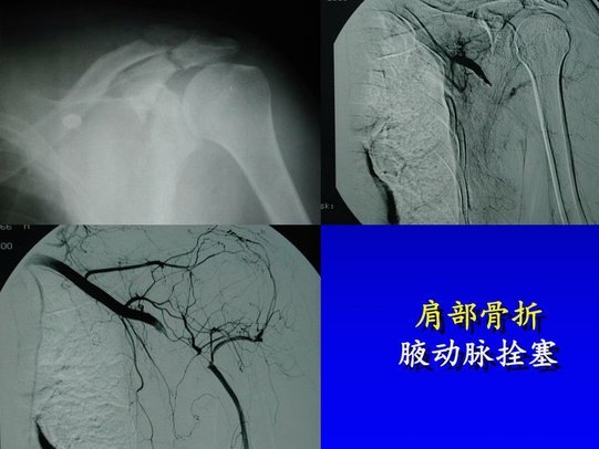 切尔西外租边锋穆德里克脚踝受伤，预计将伤缺6至8周